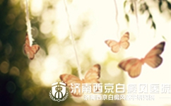 白癜风危害对病人有哪些影响