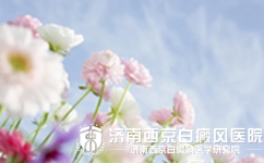 白癜风具有哪些直观的危害