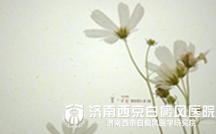 白癜风发病趋势是怎样的