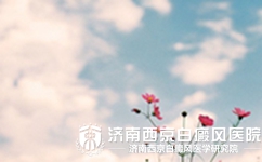黑色素栽培医治白癜风有吗
