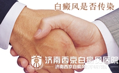 皮肤触摸白癜风传染吗