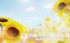 女性白癜风的危害有哪些